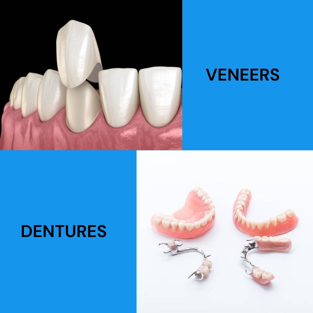 Dentures and Veneers